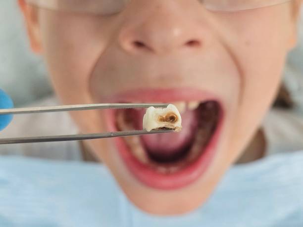 Best Emergency Dental Services for Seniors in Cramerton, NC